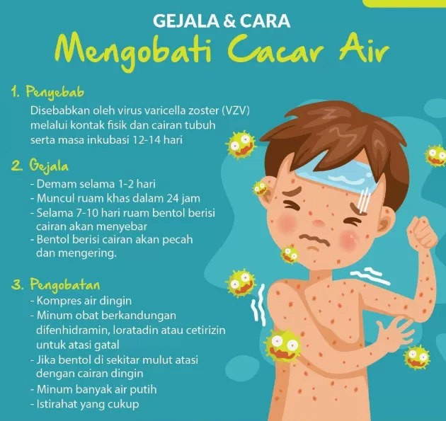 Pengertian Tentang Penyakit Cacar Air Pada Anak Anak